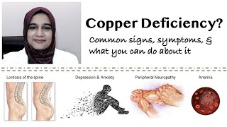 Are You Sure You Don’t Have Copper Deficiency?