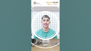 Hành trình LỘT XÁC nhờ niềng răng của Thanh Thiên