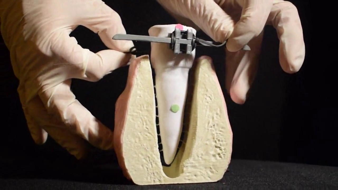 Movimientos básicos en ortodoncia