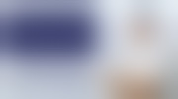 Endoscopic resection of gastric GIST by Dr Maher A. Abbas