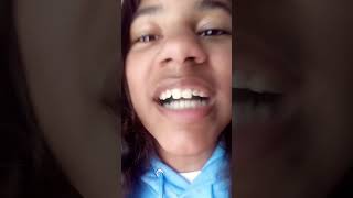 Such A Good Transition Got My Teeth Fixed How Do They Look?