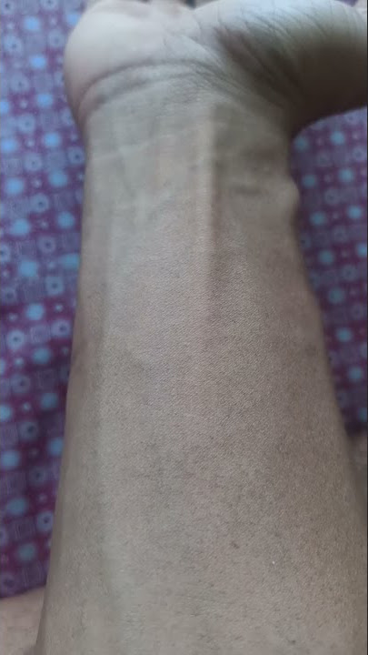 Ada Susuk Ngga Tuh. Pemain Vollyball Susuk