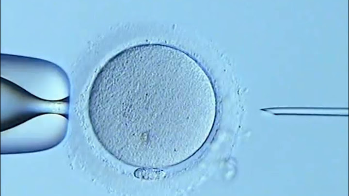 Kỹ thuật intra cytoplasmic sperm injection icsi là gì năm 2024