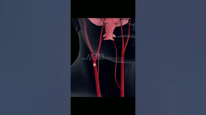 Stroke #3danimation #brain #stroke #health - DayDayNews