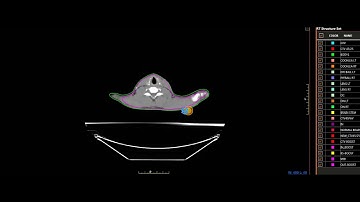 Display Dicom-RT Structure Set in WPF canvas l ITMD