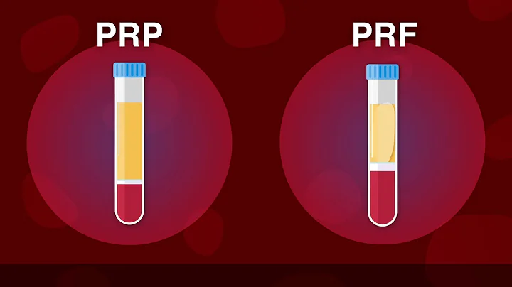 The Future of Fat- PRP vs PRF. Plastic Surgery Hot Topics with Rod J. Rohrich, MD