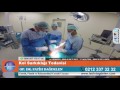 Download Op.Dr. Fatih Dağdelen - Kol Sarkıklığı Tedavisi Op.Dr. Fatih Dağdelen - Kol Sarkıklığı Tedavisi