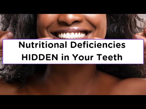 Bleeding Gums Vitamin D Deficiency