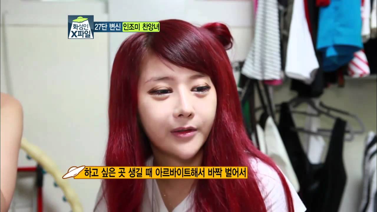 [화성인 X파일] 인조미 찬양녀, 성형수술 28회 '페이스오프' 끝판왕