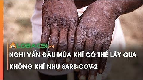 Nghi vấn đậu mùa khỉ có thể lây qua không khí như SARS-CoV-2