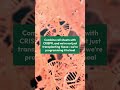 Gene Therapy 2.0: The Cell Sheet Breakthrough Changing Healthcare