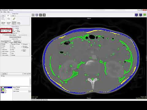Analyze 14.0 - Measure: Making 2D Area Measurements