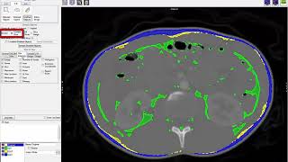 Analyze 14.0 - Measure: Making 2D Area Measurements