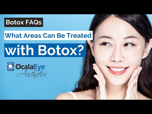 What Areas Can Be Treated with Botox?