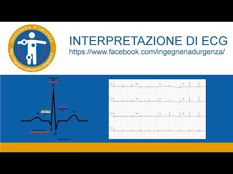 Video: Interpretazione del test ECG del cuore