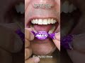 Satisfying Chewing ASMR #Compilation #ASMR #DoctorTristanPeh