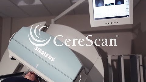 CereScan on Mild Cognitive Impairment