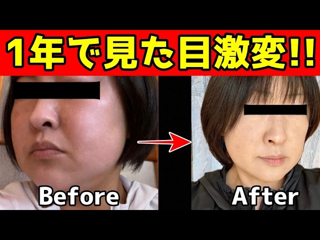 Dramatically Transform Your Look in 1 Year✨】Introducing the