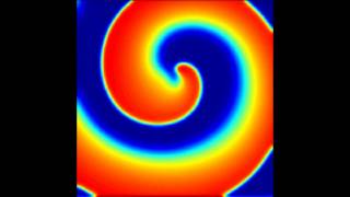 Spiral Wave Breakup To Ventricular Fibrillation