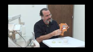 What causes sleep apnea?