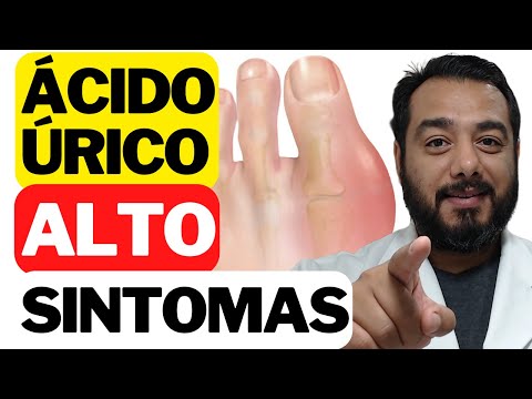 Quais são os sintomas de ácido úrico alto no sangue (hiperuricemia)? | Prof. Dr. Victor Proença