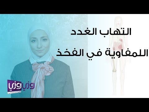 التهاب الغدد اللمفاوية في الفخذ وأماكن أخرى