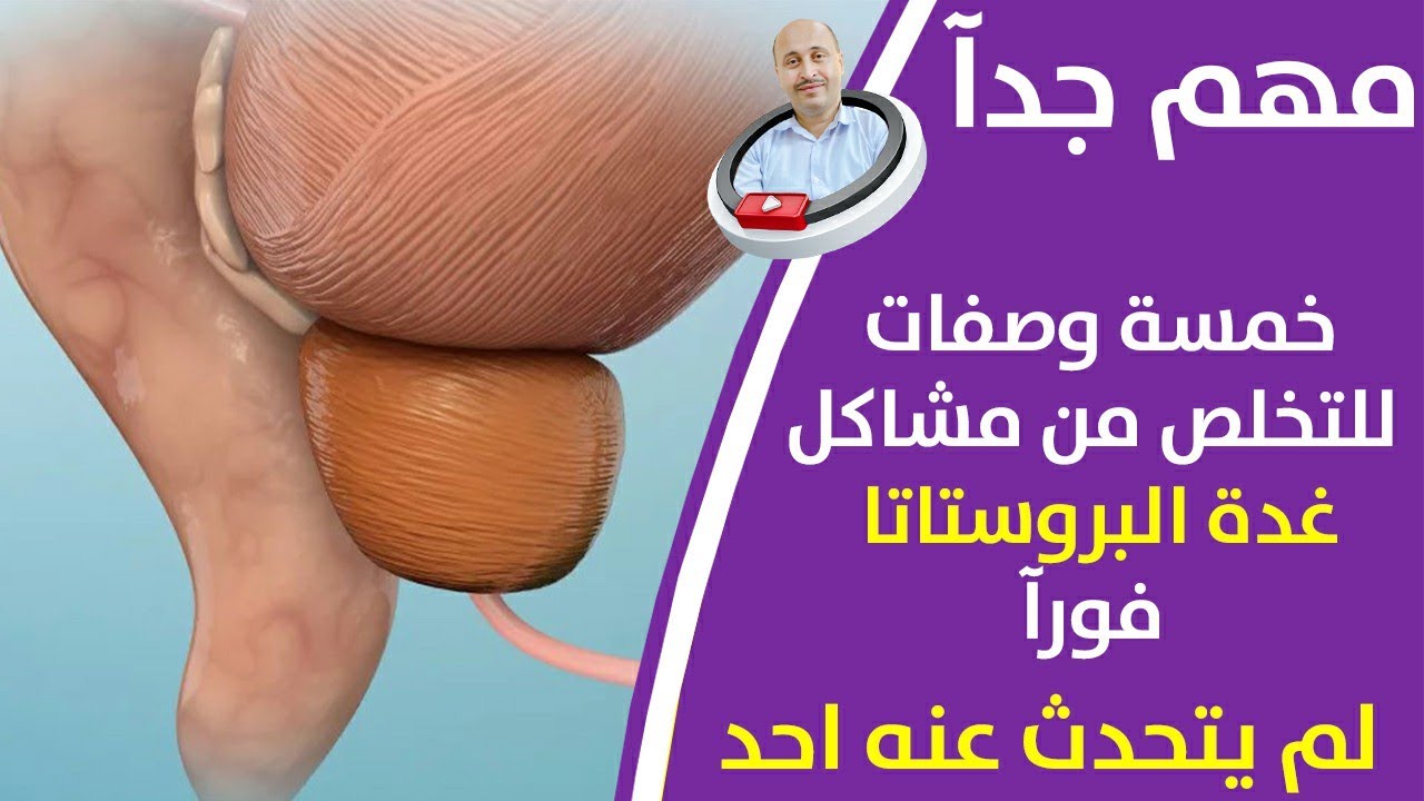 ثلاثة أسرار للتخلص من التهاب غدة البروستاتا المزمن ووقف تضخم البروستاتا والحفاظ علي صحة البروستاتا.