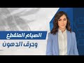 ازاى الصيام المتقطع هيحول جسمك لمحرقه دهون؟ و إيه فوائده غير فقدان الوزن!