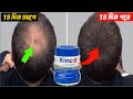 15 দিনেই চুল গজাবে 😱 Hair Growth Medicine In Bangla। চুল পড়া বন্ধ ও নতুন চুল গজানোর উপায়।
