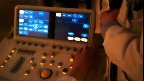 How to Perform a Myocardial Perfusion Study: Part 6 Manual Settings