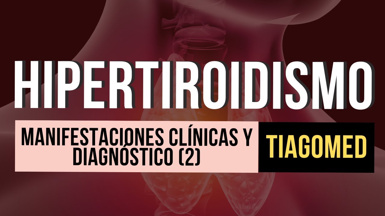 Guia De Practica Clinica Rapida Enfermedad Graves Hip vrogue.co