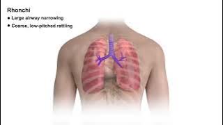 Types of Lung Sounds