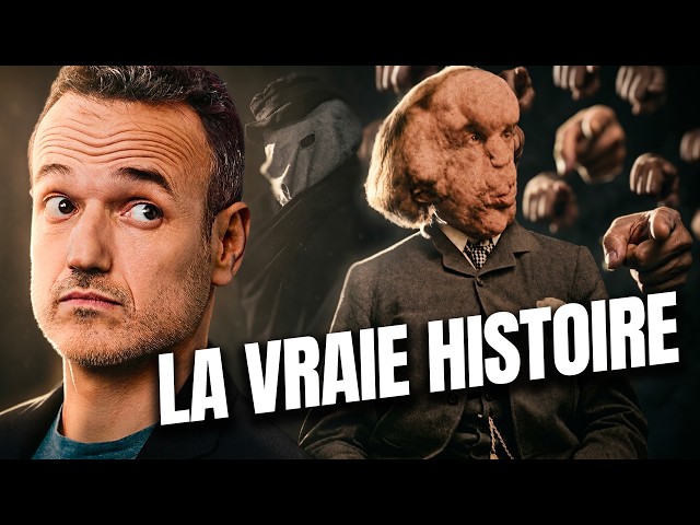 Joseph Merrick, l'Histoire du Monstre qui n'en était Pas un (alors que nous oui)