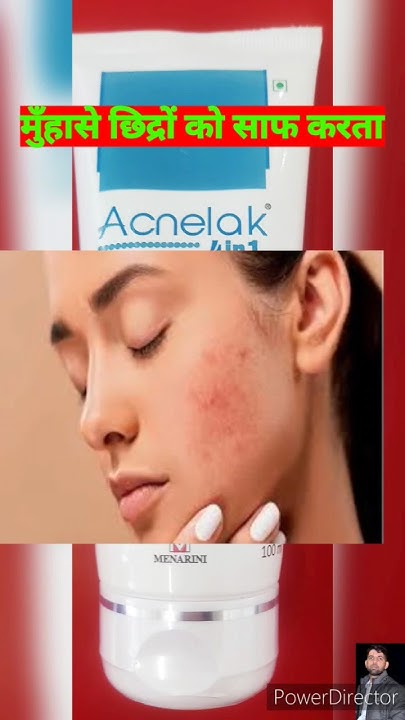 Best Face Wash Acnelak Face Wash best-face-wash-acnelak-face-wash