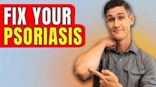 #1 Remedy for Psoriasis (My Story)