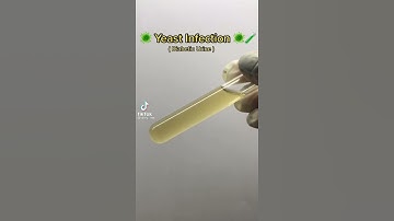 Yeast infection as seen under the microscope. #shorts #Shorts