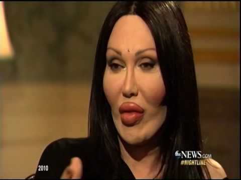 Pete Burns, Lead Singer of Dead or Alive, Has Died - ABC News