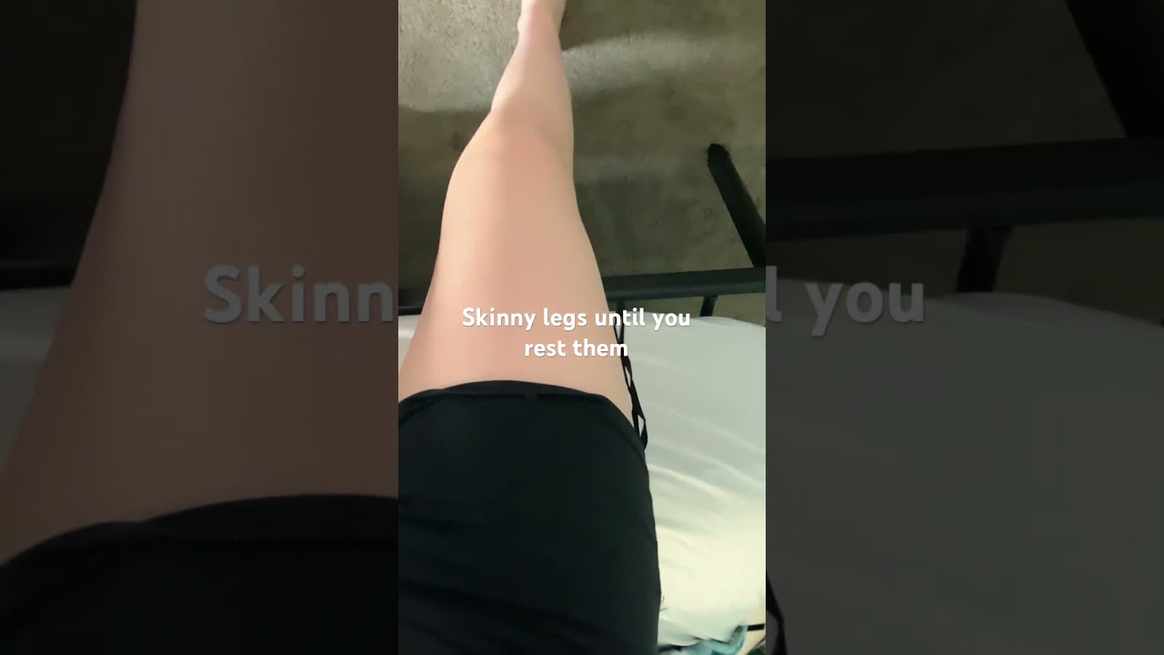 It’s so embarrassing when you put your leg down 