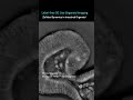 Cellular Dynamics in Intestinal Organoid