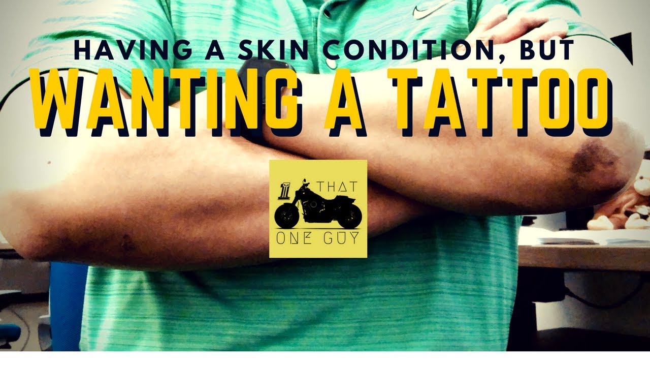 To Ink Or Not To Ink Considering A Tattoo With A Skin Condition YouTube to-ink-or-not-to-ink-considering-a-tattoo-with-a-skin-condition-youtube