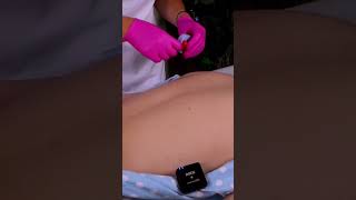 ASMR Dermatologist Exam on Acne Back | Skin Inspection & Relaxing Medical Treatment @EleynaASMR