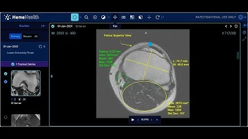 View Scan - OHIF Basic Viewer