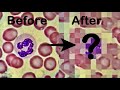 Blood Smear Analysis Quiz