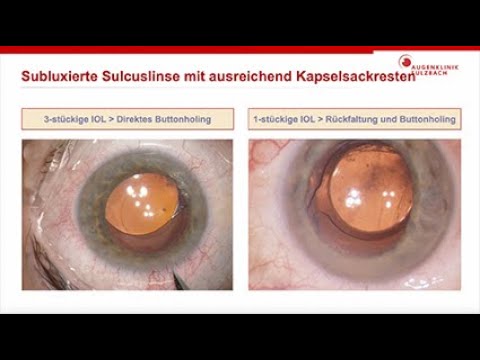 knstliche kerze mit teelichteinsatz Hochzeitskerze Luisa & Leon  Rosis Kerzen