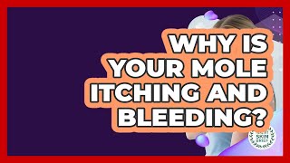Detailed Why Is Your Mole Itching And Bleeding? - Healthy Skin Brief Profile