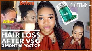 HAIR-LOSS 3 MONTHS VSG POST OP | HAIR FALLING OUT  | HOW TO GROW YOUR HAIR BACK WITH SUPPLEMENTS