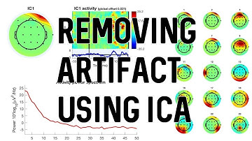 Artifact Removal Using ICA