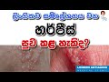 හර්පීස් සුව කළ හැකිද?