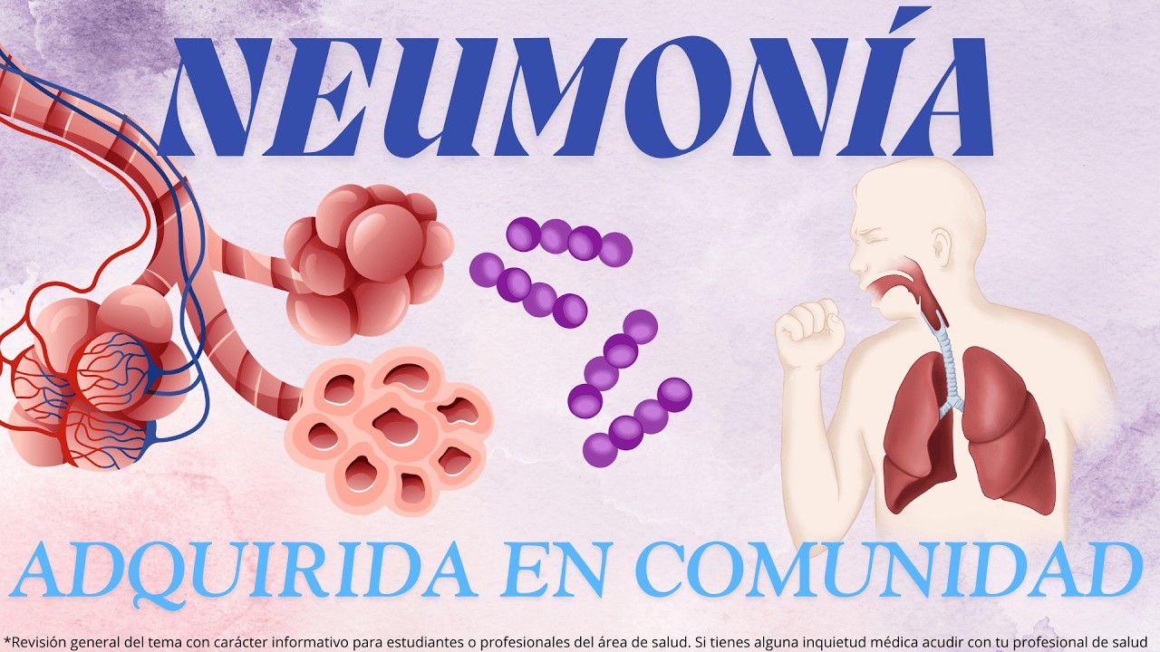 NEUMONÍA ADQUIRIDA EN COMUNIDAD