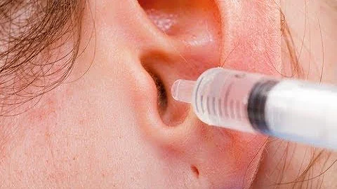 Comment Nettoyer Ses Oreilles En Profondeur
